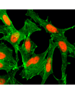 Immunocytochemical staining of HeLa cells treated with sodium butyrate, using anti-Acetyl-Histone H4 (Lys12) Rabbit Monoclonal Antibody (clone RM202) (red). Actin filaments have been labeled with fluorescein phalloidin (green).