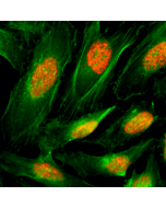 Immunocytochemistry of HeLa cells, using Anti-Histone H4 Rabbit mAb RM212 (red). Actin filaments have been labeled with fluorescein phalloidin (green).