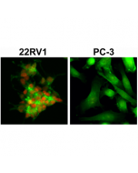 Immunocytochemical staining of 22RV1 and PC-3 cells, using anti-AR-V7 rabbit monoclonal Antibody Clone RM7 (red). Actin filaments have been labeled with fluorescein phalloidin (green).