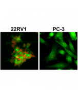 anti-AR (ARv7 Splice Variant) (human), Rabbit Monoclonal (RM7) (Biotin)