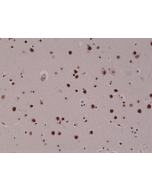 Immunohistochemical staining of formalin fixed and paraffin embedded human brain tissue sections, using rabbit monoclonal anti-5-hmC (clone RM236) antibody.