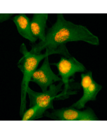 Immunocytochemical staining of HeLa cells, using Anti-Histone H2B Rabbit mAb RM230 (red). Actin filaments have been labeled with fluorescein phalloidin (green).