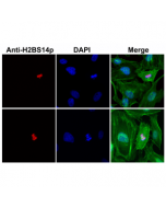 Immunocytochemistry of HeLa cells using Anti-Phospho-Histone H2B (Ser14) Rabbit mAb RM238 (red) and DAPI (blue). Actin filaments have been labeled with fluorescein phalloidin (green).