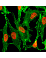 Immunocytochemistry of HeLa cells treated with sodium butyrate, using Acetyl-Histone H2B (Lys23) rabbit monoclonal antibody (RM260) (red). Actin filaments have been labeled with fluorescein phalloidin (green).