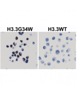 Immunohistochemical staining of formalin fixed and paraffin embedded 293T cells transfected with a DNA construct encoding Histone H3.3 G34W mutant or wild type, stained with anti-Histone H3.3 G34W clone RM263.