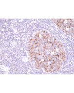 Immunohistochemical staining of formalin fixed and paraffin embedded human tonsil tissue sections using Anti-Aurora B Rabbit Monoclonal Antibody (Clone RM278) at a 1:500 dilution.