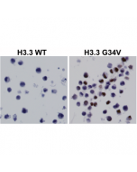 Immunohistochemical staining of formalin fixed and paraffin embedded 293T cells transfected with a DNA construct encoding Histone H3.3 wild type or G34V mutant, stained with anti-Histone H3.3 G34V rabbit monoclonal antibody (clone RM307).