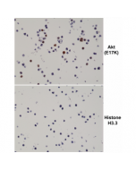 Immunohistochemical staining of formalin fixed and paraffin embedded 293T cells transfected with a DNA construct encoding the Akt E17K mutation or Histone H3.3, stained with anti-Akt E17K rabbit monoclonal antibody (clone RM336) at 0.2ug/mL.