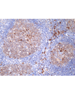 Immunohistochemical staining of formalin fixed and paraffin embedded human tonsil tissue section using anti-CD38 rabbit monoclonal antibody (Clone RM388) at a 1:100 dilution.