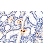 Immunohistochemical staining of formalin fixed and paraffin embedded human stomach using Anti-H.Pylori Rabbit Monoclonal Antibody (Clone RM400) at a 1:100 dilution.