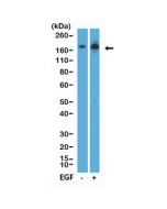 anti-EGFR (phospho Y1068) (human), Rabbit Monoclonal (RM443)