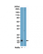 anti-Acetyl-Histone H2B (Lys5), Rabbit Monoclonal (RM455)