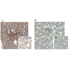 Immunohistochemical staining of human tissue using anti-ANGPTL4 (human), mAb (Kairos-1) (Prod. No. AG-20A-0038) at 1:500 dilution.A. Immunoperoxidase staining of formalin-fixed, paraffin-embedded human spleen (200x).A-1. Isotype control (negat