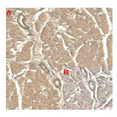 Immunohistochemical staining of human tissue using anti-IL-33 (human), mAb (IL33305B) (Prod. No. AG-20A-0041) at 1:100 dilution.A. Immunoperoxidase staining (cytoplasmic) of formalin-fixed, paraffin-embedded human heart (100x, brown colour).B.