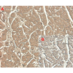 Immunohistochemical staining of human tissue using anti-ST2 (human), mAb (ST33868) (Prod. No. AG-20A-0044) at 1:100 dilution. A. Immunoperoxidase staining (cytoplasmic) of formalin-fixed, paraffin-embedded human heart (100x, brown colour). B. 