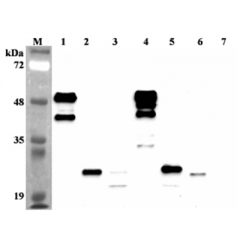 Western blot analysis using anti-FGF-21 (human), mAb (FG224-7) (Prod. No. AG-20A-0051) at 1:2'000 dilution.1: Human FGF-21 Fc-protein.2: Human FGF-21 (FLAG®-tagged).3: Human FGF-21 (His-tagged).4: Mouse FGF-21 Fc protein