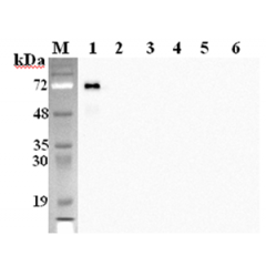Western blot analysis using anti-DLK1 (mouse), mAb (PF183E) (Prod. No. AG-20A-0058Y) at 1:2'000 dilution.1: Mouse DLK1 Fc-protein.2: Human DLK1 Fc-protein.3: Mouse DLL1 Fc-protein.4: Mouse DLL4 Fc protein.5: Mouse Jagged-1 Fc