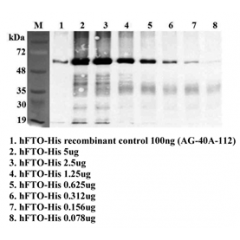 Immunoprecipitation of recombinant human FTO using anti-FTO (human), mAb (FT86-4) (Prod. No. AG-20A-0064). Recombinant human FTO proteins at different concentrations were precipitated by FT86-4. The precipitated proteins were separated by SDS-PAGE, electr