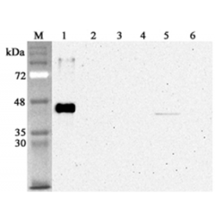 Western blot analysis using anti-Sirtuin 2 (human), mAb (S2R233-1) (Prod. No. AG-20A-0076) at 1:4'000 dilution.1: Human sirtuin 2 (His-tagged).2: Human sirtuin 1 (His-tagged).3: Human sirtuin 5 (His-tagged).4: Human sirtuin 6 (His-