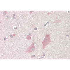 Immunohistochemical staining of NMNAT2 using anti-NMNAT2 (human), mAb (Nady-1) (Prod. No. AG-20A-0087) in human brain cortex tissue (10µg/ml). This antibody has been tested in immunohistochemistry, analyzed by an anatomic pathologist and valid