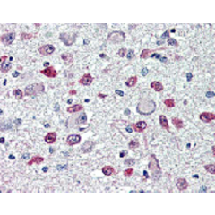 Immunohistochemical staining of FTO with anti-FTO (human), mAb (AG103) (Prod. No. AG-20A-0092) in brain, hypothalamus and paraventricular nucleus (5~10 μg/ml). This antibody has been tested in immunohistochemistry, analyzed by an anatomic patholo