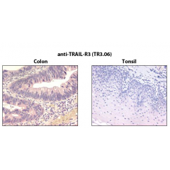 Immunohistochemistry detection of endogenous TRAIL-R3 in paraffin-embedded human carcinoma tissues (colon, tonsil) using mAb to TRAIL-R3 (TR3.06) (Prod. No. AG-20B-0029).