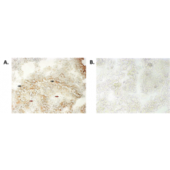 Immunohistochemical staining of bioptic sections of small intestine using anti-NLRP6/NALP6 (human), mAb (Clint-1) (AG-20B-0046) at 1:500 dilution. Method: A) Epithelial tissues which express NLRP6 (positive control) (black arrows) and connective ti