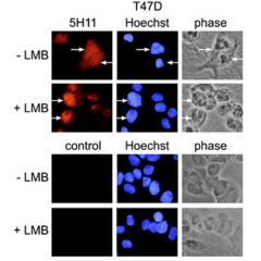 Immunofluorescence using anti-PARP-10 [ARTD10] (human), mAb (5H11). Method: T47D mammary carcinoma cells were stained by indirect immunofluorescence and analysed. Prior to fixation and staining, the cells were treated with or without 50nm leptomyci