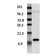 Western blot analysis of adipocyte-conditioned medium from human male and female with different expression levels using anti-Resistin (human), pAb (Prod. No. AG-25A-0013).