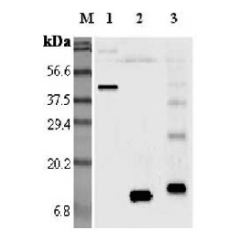 Western blot analysis using anti-Resistin (mouse), pAb (Prod. No. AG-25A-0014) at 1:5'000 dilution.
1: Mouse Resistin Fc-protein.
2: Mouse Resistin.
3: Mouse Resistin (His-tagged).
