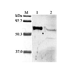 Western blot analysis of human ANGPTL6 using anti-ANGPTL6 (Prod. No. AG-25A-0030) at 1:2,000 dilution.
1. Recombinant human ANGPTL6 (FLAG®-tagged).
2. HepG2 cells lysate.