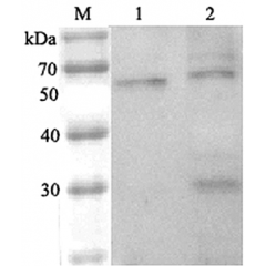 Western blot analysis using anti-ANGPTL6 (human), pAb (Prod. No. AG-25A-0037) at 1:2'000 dilution.
1: Human ANGPTL6 (FLAG®-tagged).
2: HepG2 cell lysate.