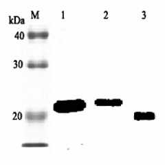 Western blot analysis using anti-RBP4 (rat), pAb (Biotin) (Prod. No. AG-25A-0039B) at 1:2'000 dilution.
1: Rat RBP4 (His-tagged).
2: Rat RBP4 (FLAG®-tagged).
2: Rat serum (GK/SIc) (1μl).