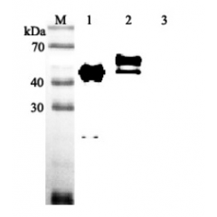 Western blot analysis using anti-Vaspin (human), pAb (Prod. No. AG-25A-0048) at 1:2'000 dilution.
1: Human Vaspin (His-tagged).
2: Human Vaspin (FLAG®-tagged).
3: Mouse IL-33 (His-tagged) (negative control).