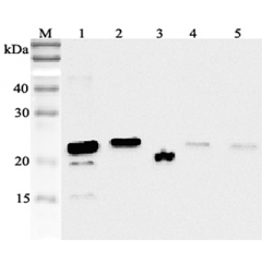 Western blot analysis using anti-RBP4 (human), pAb (Prod. No. AG-25A-0053) at 1:2'000 dilution.
1: Human RBP4 (His-tagged).
2: Human RBP4 (FLAG®-tagged).
3: Human serum (2μl).
4: Mouse RBP4 (FLAG®-tagged).