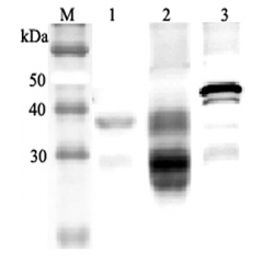 Western blot analysis using anti-Clusterin (mouse), pAb (Prod. No. AG-25A-0054) at 1:2'000 dilution.
1: Mouse serum (2μl).
4: Mouse seminal plasma.
5: Mouse Clusterin (nuclear form) (His-tagged).