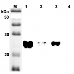 Western blot analysis of human tissue lysate using anti-TRB3 (human), pAb (Prod. No. AG-25A-0059) at 1:2,000 dilution.
1. Human spleen tissue lysate (10μg).
2. Human liver tissue lysate (10μg)
3. Human colon tissue lysate (10μg)