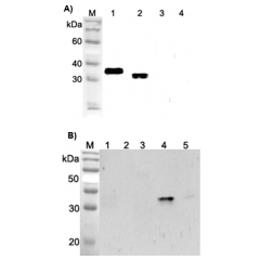 Western blot analysis using anti-ANGPTL4 (FLD) (human), pAb (Prod. No. AG-25A-0065) at 1:2'000 dilution.
A)
1: Human ANGPTL4 (FLD) (FLAG®-tagged).
2: Human ANGPTL4 (FLAG®-tagged).
3: Human ANGPTL4 (CCD) (FLAG