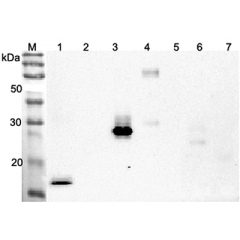 Western blot analysis using anti-ANGPTL4 (CCD) (human), pAb (Prod. No. AG-25A-0066) at 1:2'000 dilution.
1: Human ANGPTL4 (CDD) (FLAG®-tagged).
2: Human ANGPTL4 (FLAG®-tagged).
3: Human ANGPTL3 (CCD) (FLAG®
