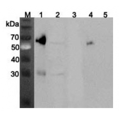 Western blot analysis using anti-ANGPTL3 (mouse), pAb (Prod. No. AG-25A-0070) at 1:2'000 dilution.
1: Mouse ANGPTL3 (FLAG®-tagged) (40ng).
2: Mouse liver cell lysate (Balb/c mouse, 150μg).
3: Mouse ANGPTL4 (FLAG®
