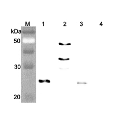 Western blot analysis of human FGF21 using anti-FGF-21 (human), pAb (Prod. No. AG-25A-0074) at 1:4,000 dilution.. 1. Recombinant human FGF21 (FLAG-tagged). 2. Recombinant human FGF21 (Fc protein). 3. Recombinant human FGF21 (His-tagged).