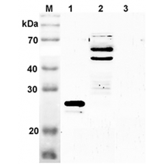 Western blot analysis using anti-SENP2 (mouse), pAb (Prod. No. AG-25A-0078) at 1:2'000 dilution.
1: Mouse SENP2 (catalytic domain) (His-tagged).
2: Mouse brain cell lysate (Balb/c mouse, 70μg)
3: Mouse IDO (His-tagged) (negative contr