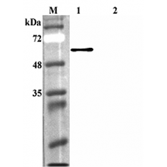 Western blot analysis using anti-FTO (human), pAb (Prod. No. AG-25A-0084) at 1:4'000 dilution.
1: Human FTO (His-tagged).
2: Human Sirtuin 1 (His-tagged) (negative control).