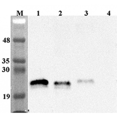Western blot analysis using anti-Lipocalin-2 (human), pAb (Prod. No. AG-25A-0087) at 1:4'000 dilution.
1: Human Lipocalin-2 (FLAG®-tagged).
2: Mouse Lipocalin-2 (FLAG®-tagged).
3: Rat Lipocalin-2 (FLAG®-t
