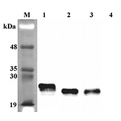 Western blot analysis using anti-Lipocalin-2 (rat), pAb (Prod. No. AG-25A-0088) at 1:4'000 dilution.
1: Rat Lipocalin-2 (FLAG®-tagged).
2: Mouse Lipocalin-2 (FLAG®-tagged).
3: Human Lipocalin-2 (FLAG®-tag