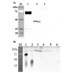 Western blot analysis of human DLK1 using anti-DLK1 (human), pAb (Prod. No. AG-25A-0091) at 1: 2,000 dilution.
A.
1. Human DLK1 (Fc protein).
2. Transfected human DLK1 full length cell lysate (HEK 293).
3. Mock Transfected HEK293 c