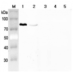 Western blot analysis using anti-Progranulin (mouse), pAb (Prod. No. AG-25A-0093) at 1:2'000 dilution.
1: Mouse Progranulin (FLAG®-tagged).
2: Human Progranulin (FLAG®-tagged).
3: Human Granulin C (FLAG®-