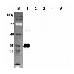 Western blot analysis using anti-Sirtuin 5 (human), pAb (Prod. No. AG-25A-0100) at 1:2'000 dilution.
1: Human Sirtuin 5 (intact form) (His-tagged).
2: Human Sirtuin 1 (His-tagged).
3: Human Sirtuin 2 (His-tagged).
4: Human Sirtuin 