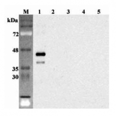 Western blot analysis using anti-Sirtuin 6 (human), pAb (Prod. No. AG-25A-0101) at 1:2'000 dilution.
1: Human Sirtuin 6 (intact form) (His-tagged).
2: Human Sirtuin 1 (His-tagged).
3: Human Sirtuin 2 (His-tagged).
4: Human Sirtuin 