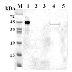 Western blot analysis using anti-TDO (human), pAb (Prod. No. AG-25A-0106) at 1:2'000 dilution.
1: Human TDO (His-tagged).
2: Human IDO (His-tagged).
3: Mouse IDO (His-tagged).
4: SH-sy5y cell lysate.
5: Unrelated protein (His